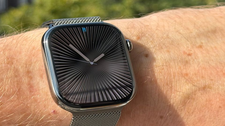 Apple Watch Series 10 on a man’s arm