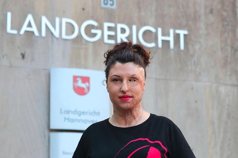 Vanessa Münstermann vor dem Landgericht Hannover nach dem Säureangriff
