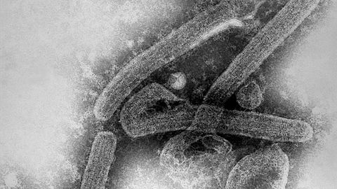 Ultrastrukturelle Morphologie einer Reihe von Marburg-Virus-Virionen