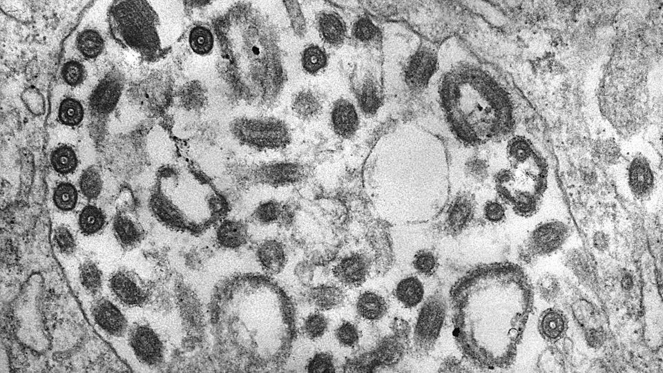 Marburg virus microscope image Marburg virus microscope image