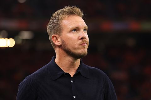 Julian Nagelsmann schaut nachdenklich