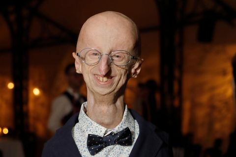 Sammy Basso, festlich gekleidet in dunklem Anzug, hebt die Daumen