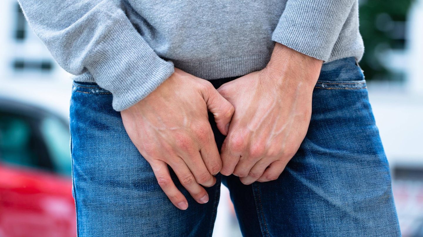 Medizinische Rarität: Mann lebte wohl ohne es zu wissen mit drei Penissen