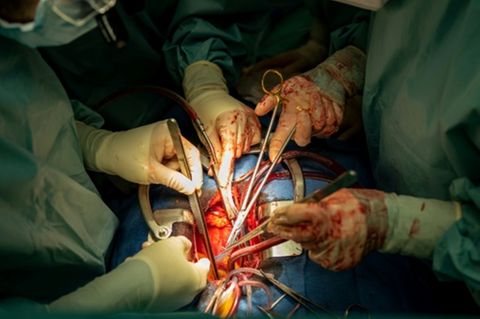 Operation