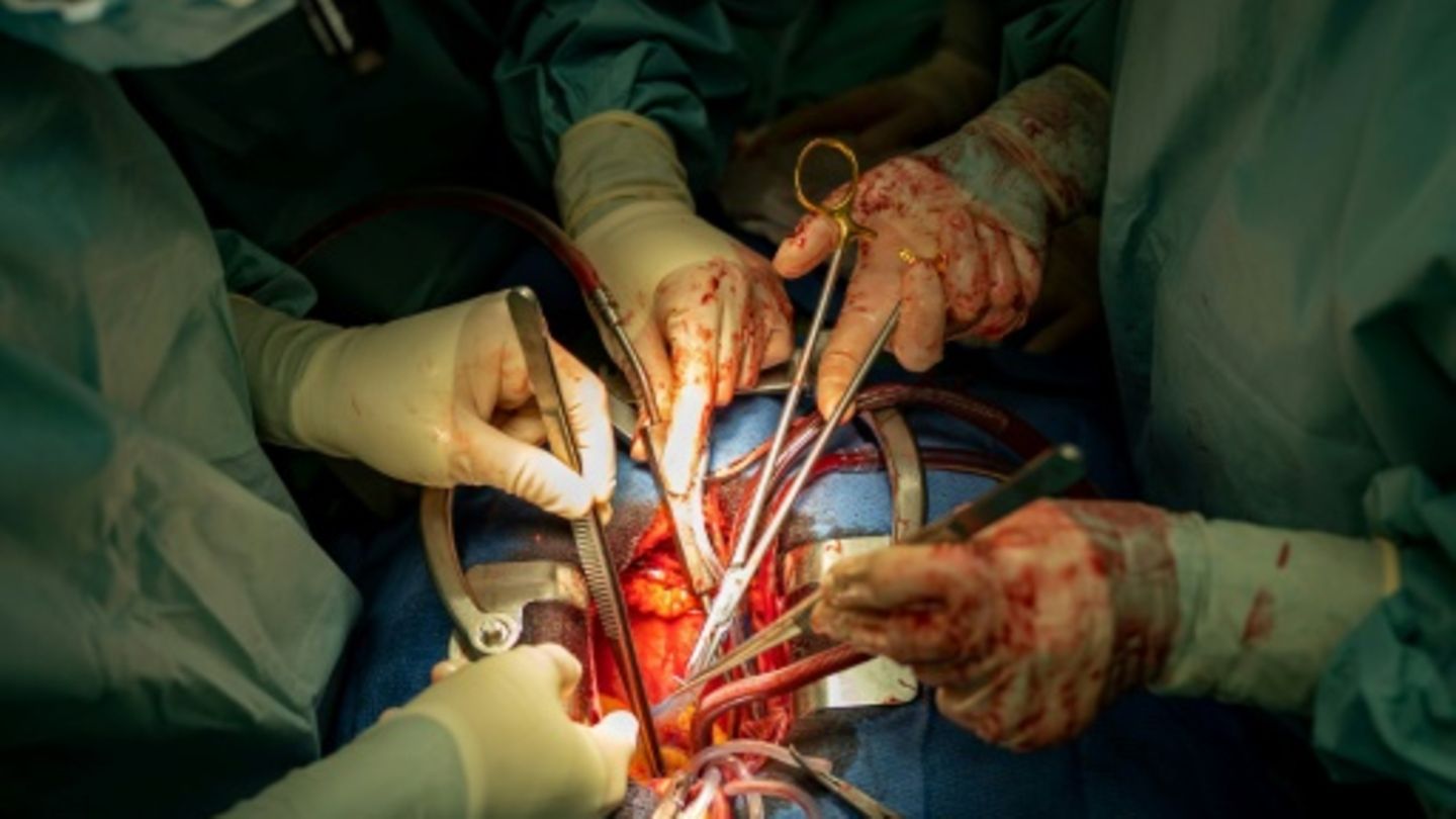 Operation