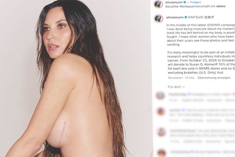 Hollywood-Star Olivia Munn zeigt Narben nach Brustkrebs-OP