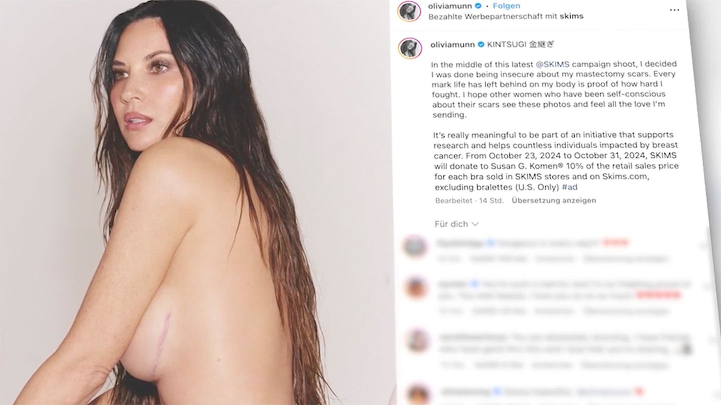 Hollywood star Olivia Munn shows scars after breast cancer surgery (video)