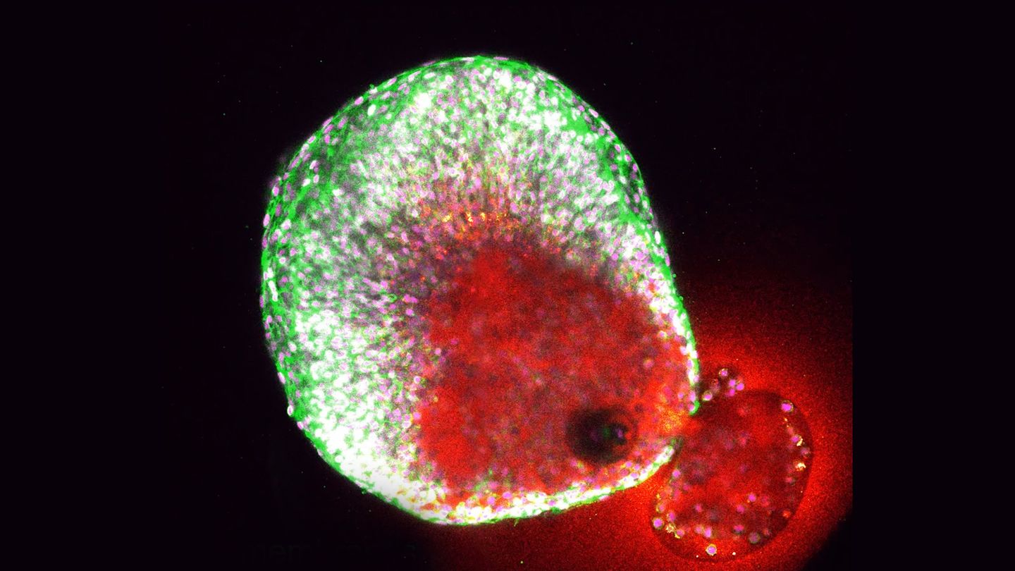 Drei Phasen: Wissenschaftliche Sensation: Erstmals Eisprung in Echtzeit gefilmt