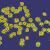 Krankheitserreger Staphylococcus unter dem Elektronenmikroskop