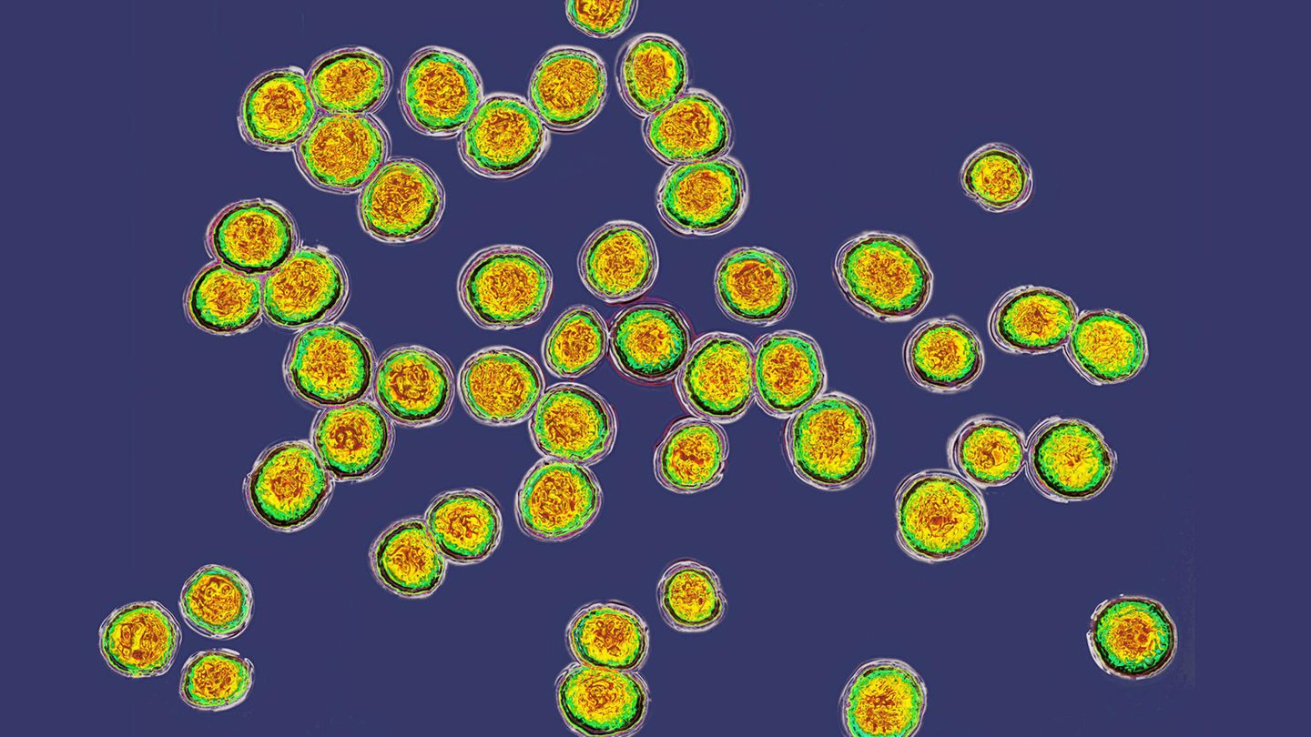 Krankheitserreger Staphylococcus unter dem Elektronenmikroskop