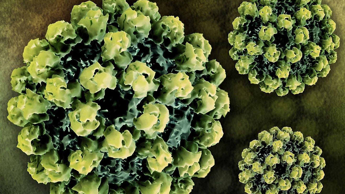 Krankheitserreger kolorierte Animation eines Norovirus