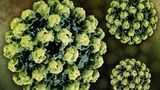 Krankheitserreger kolorierte Animation eines Norovirus
