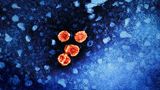 Hepatitis B Virus Elekronenmikroskopische Aufnahme