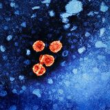 Hepatitis B Virus Elekronenmikroskopische Aufnahme