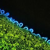 HIV Krankheitserreger