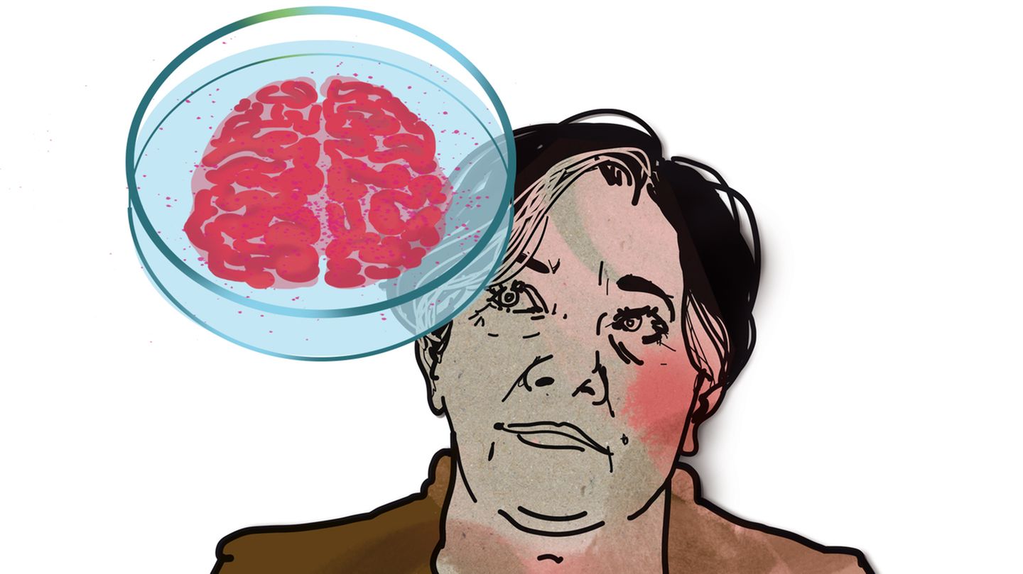 Illustration zur Diagnose "Seltene Gehirnentzündung" Illustration zur Diagnose "Seltene Gehirnentzündung"