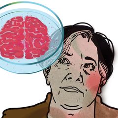Illustration zur Diagnose "Seltene Gehirnentzündung"