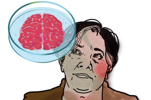 Illustration zur Diagnose "Seltene Gehirnentzündung"