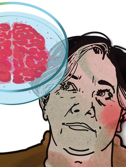 Illustration zur Diagnose "Seltene Gehirnentzündung"