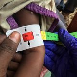 Somalia: Ein Arzt misst den Armumfang eines unterernährten Babys