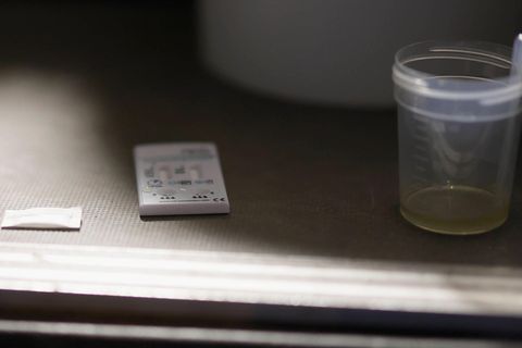 Im Kreis Göttingen gab es eine kuriose Urinprobe