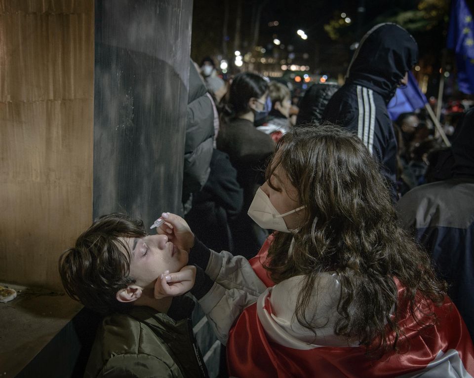 Ein Mädchen tropft einem Jungen Augentropfen in die Augen nachdem von der Polizei Tränengas versprüht hat