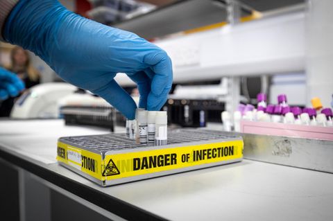 Australien: Viren aus Labor verschwunden