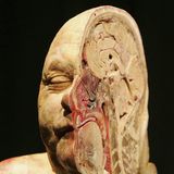 Gunther von Hagens geteilter Kopf