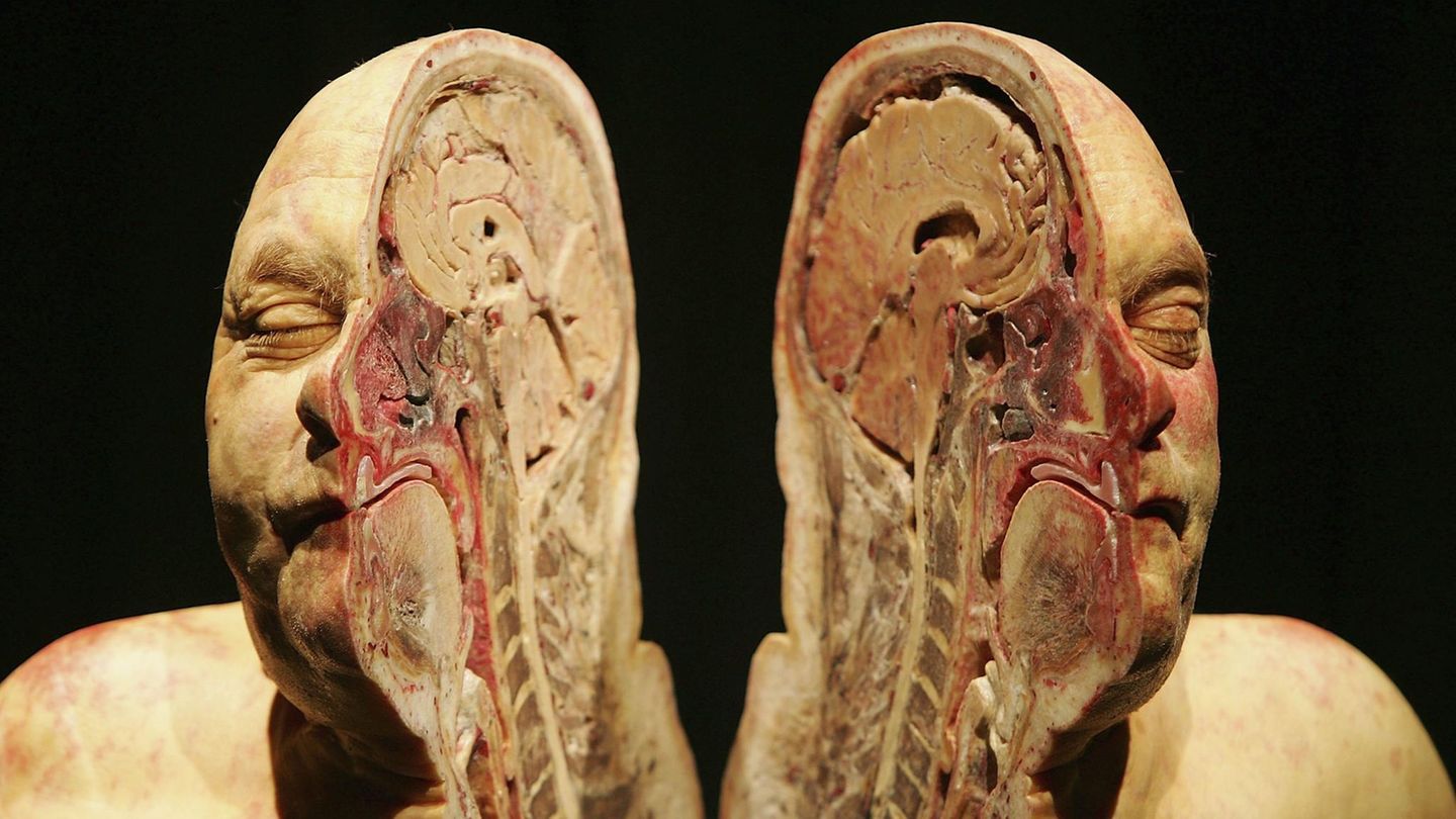 Gunther von Hagens geteilter Kopf