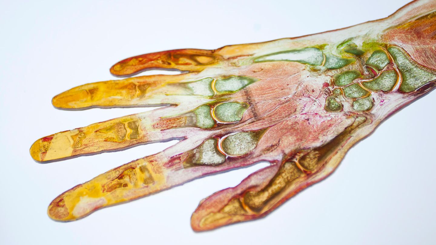 Gunther von Hagens Hand Längsschnitt