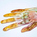 Gunther von Hagens Hand Längsschnitt