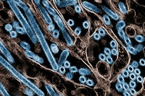 Seit Anfang 2024 wurde in den USA nach offiziellen Zahlen bei 66 Menschen eine Infektion mit dem Vogelgrippe-Virus festgestellt