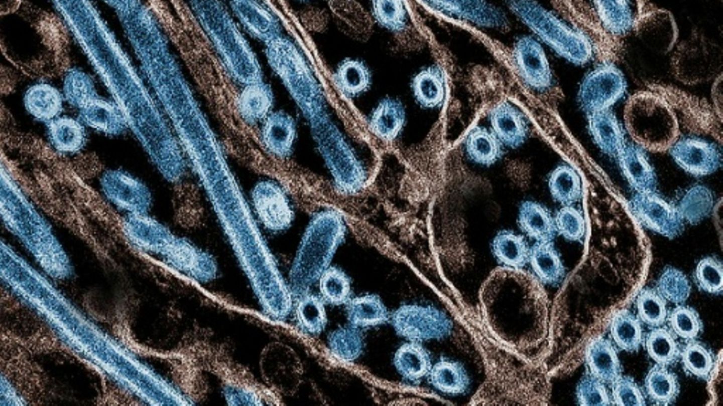 Seit Anfang 2024 wurde in den USA nach offiziellen Zahlen bei 66 Menschen eine Infektion mit dem Vogelgrippe-Virus festgestellt