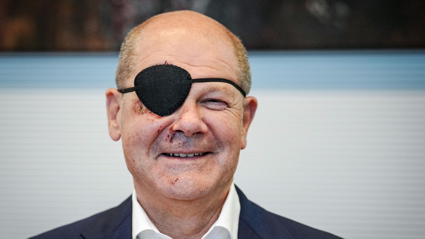 Olaf Scholz mit Augenklappe