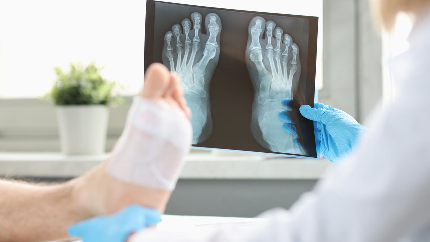 Fußchirurgie: Das sind ausgezeichnete Ärzte