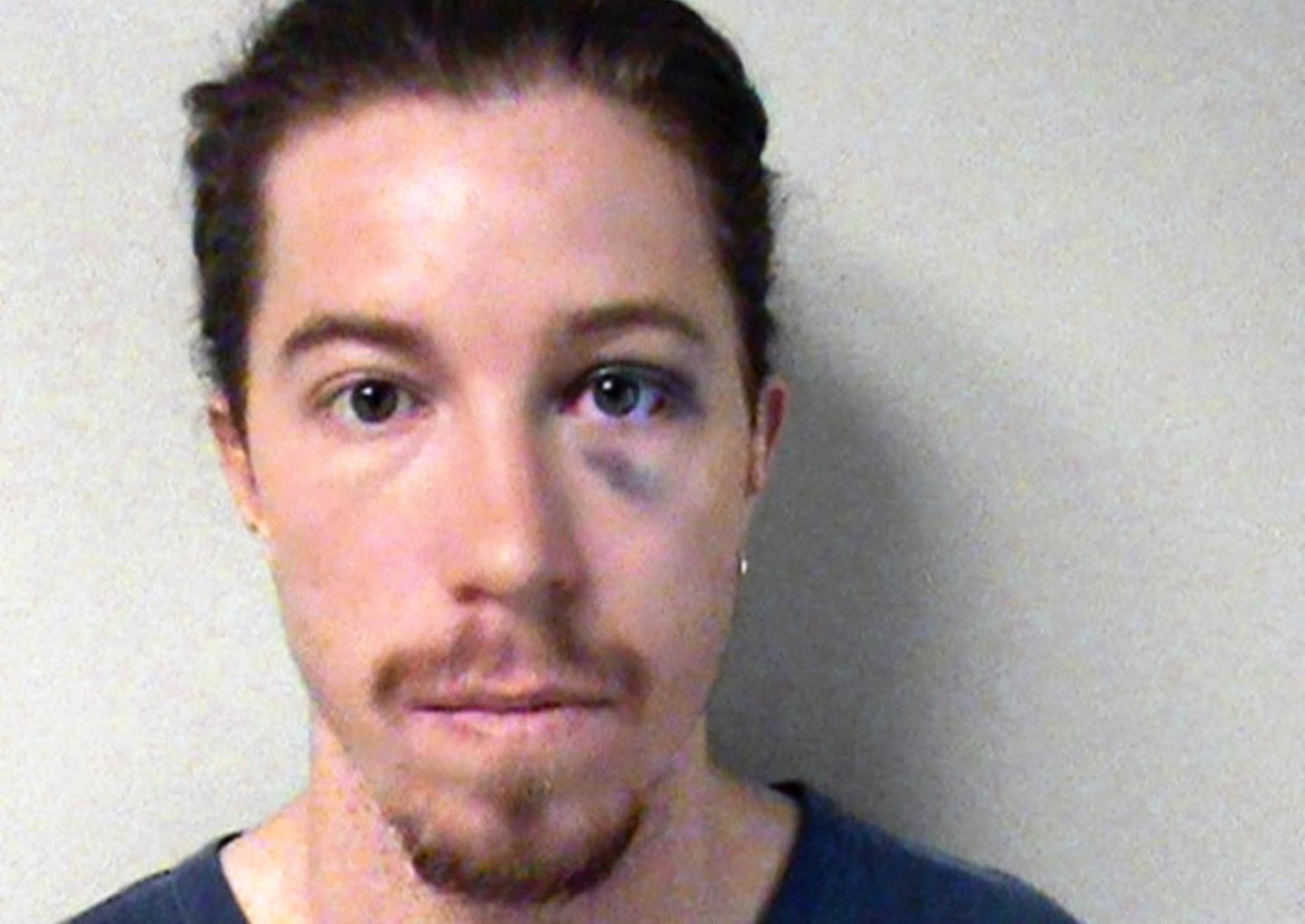 Polizeifoto von Shaun White