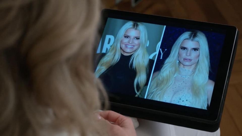 Eine Dermatologin erklärt das Phänomen hinter dem sogenannten "Ozempic-Face" – und warum gewisse Folgen der Abnehmspritze auch nicht mehr rückgängig gemacht werden können.