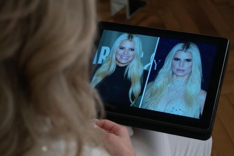Eine Dermatologin erklärt das Phänomen hinter dem sogenannten "Ozempic-Face" – und warum gewisse Folgen der Abnehmspritze auch nicht mehr rückgängig gemacht werden können.