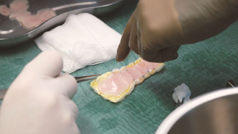 Ein Herzpflaster wird für die Implantation vorbereitet
