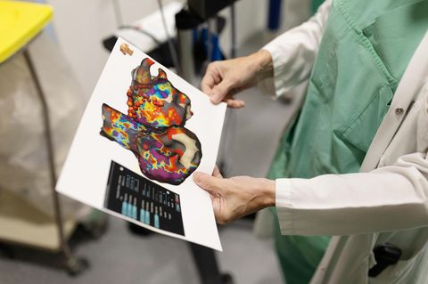 Ausdruck des Herzens vom Patienten nach der OP
