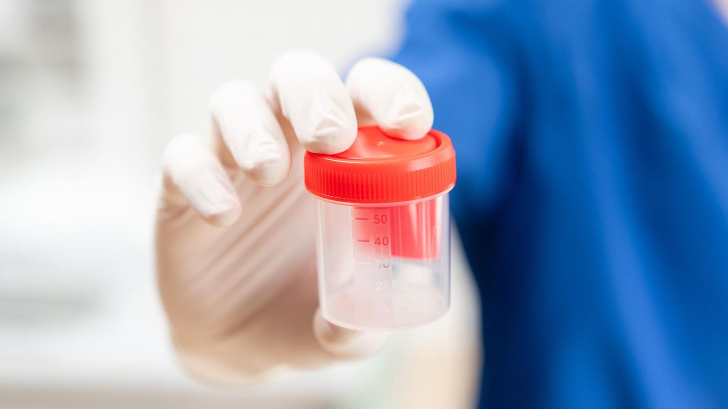 Ein Doktor hält einen Behälter für eine Spermaanalyse (Symbolbild)