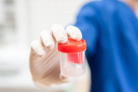 Ein Doktor hält einen Behälter für eine Spermaanalyse (Symbolbild)