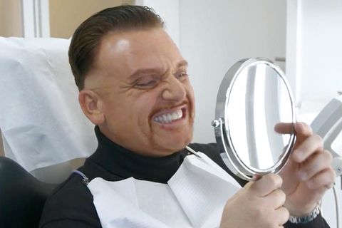 Menowin Fröhlich bekommt neue Zähne