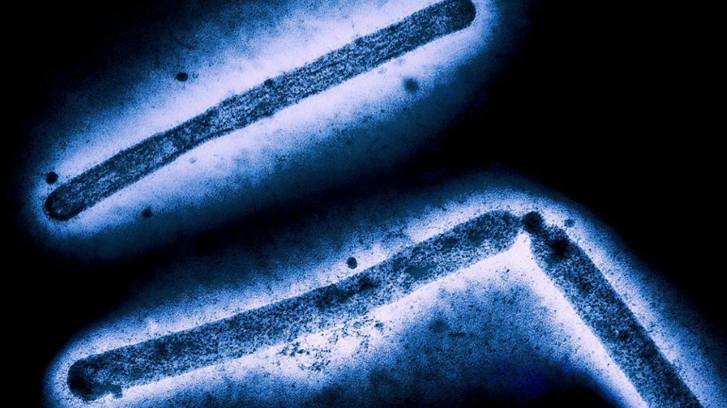 Partikel des Vogelgrippe-Virus' H5N1