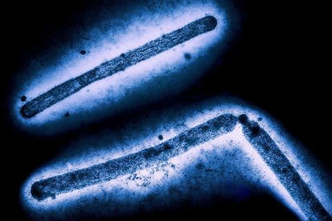 Partikel des Vogelgrippe-Virus' H5N1