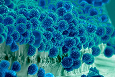 Die Pollen der Ambrosia zählen zu den stärksten Allergieauslösern. 2024 haben sie einen Zuwachs von etwa 500 Prozent im Vergleich zum Vorjahr erlebt