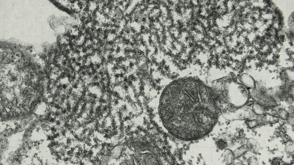 Das Nipah-Virus unter dem Mikroskop Das Nipah-Virus unter dem Mikroskop