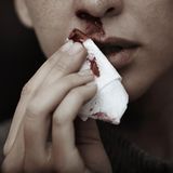 Körper: Hand hält Taschentuch unter blutende Nase