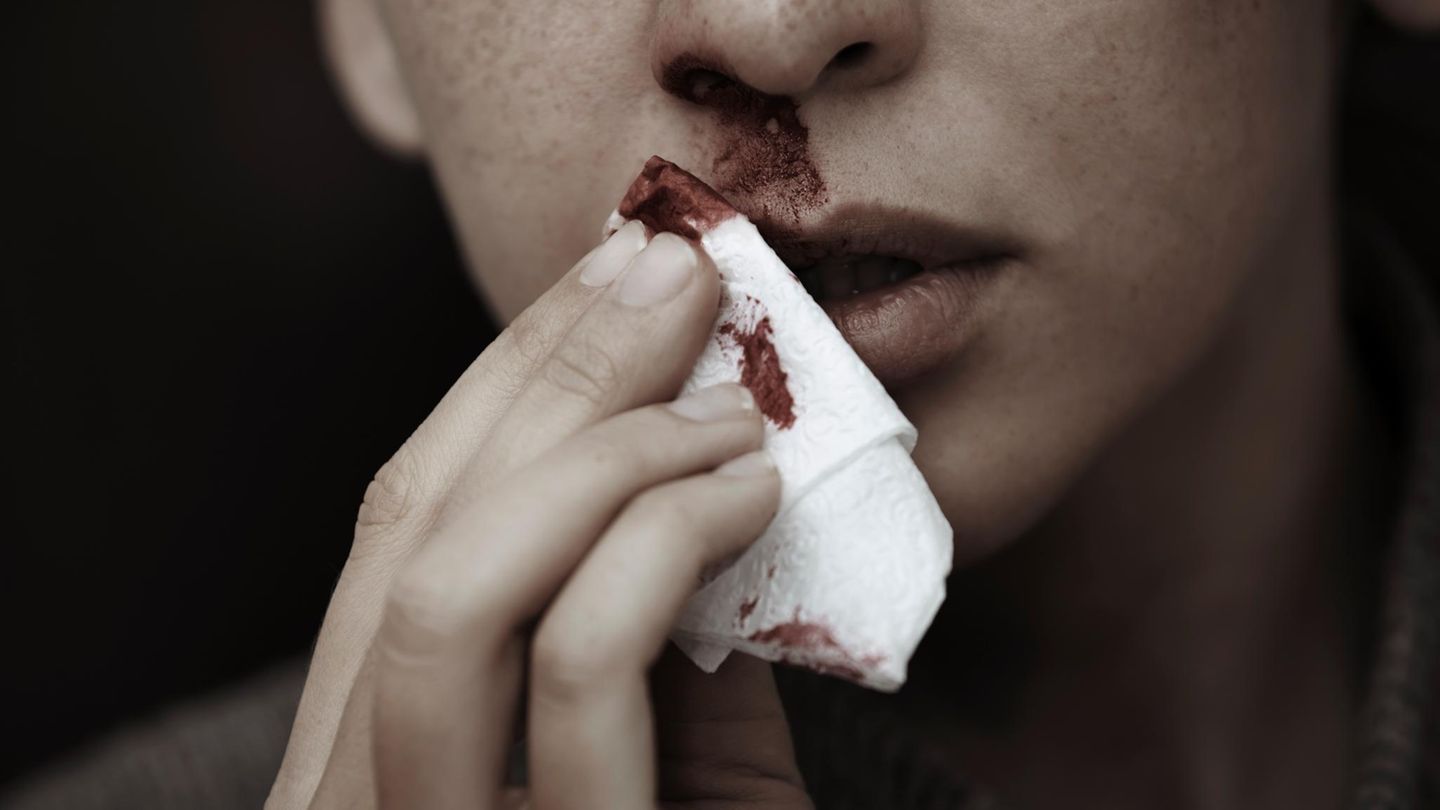 Körper: Hand hält Taschentuch unter blutende Nase