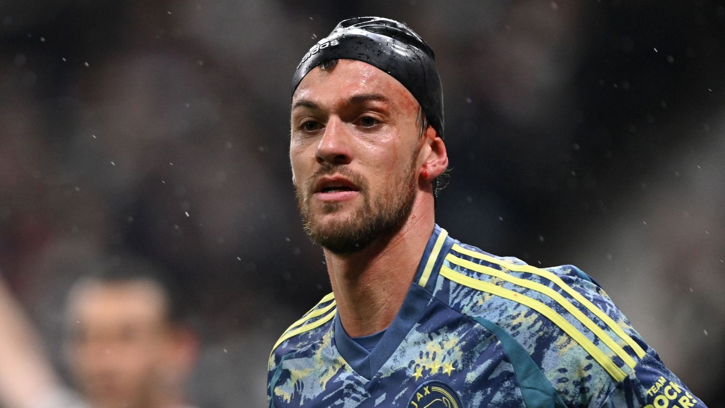 Daniele Rugani bedeckt seine Platzwunde im Spiel gegen Eintracht Frankfurt mit einer Badekappe
